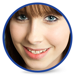 clear orthodontics in williamsville ny